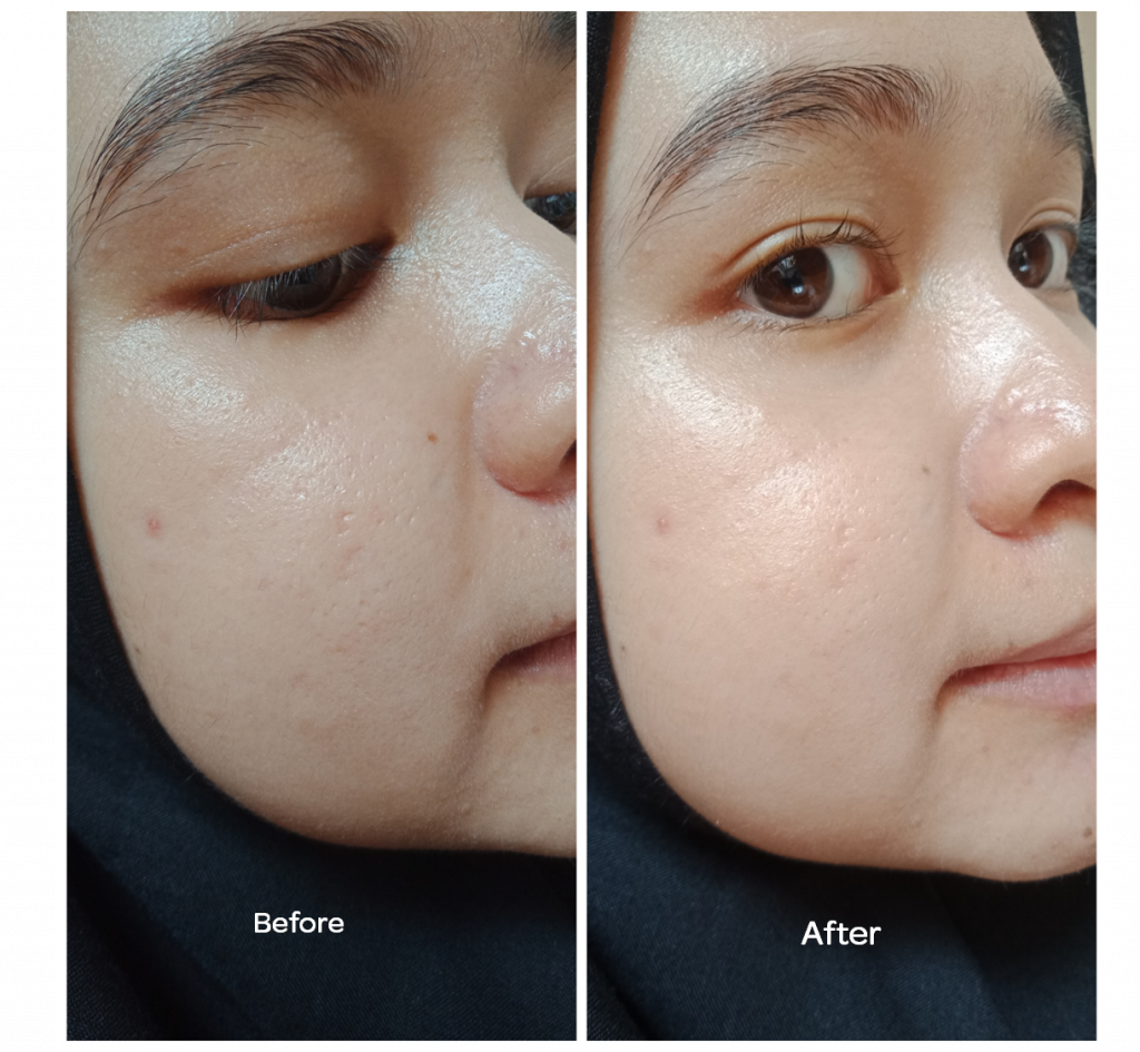 jbb-editor-choice-mustika-ratu-series-2 Mustika ratu, produk lokal, recomended, produk lokal recomended, rekomendasi cushion lokal, rekomendasi primer lokal, rekomendasi promer affordable, rekomendasi lipmatte lokal, mustika ratu, rekomendasi eyebrow matic, cushion mustika ratu, lipmatte mustika ratu, minyak zaitun mustika ratu, cushion mustika ratu, bb cushion mustika ratu, cleanser mustika atu, mustika ratu, makeup lokal, makeup tahan lama, makeup lokal tahan lama, make up lokal tahan lama, rekomendasi produk mustika ratu, rekomendasi produk halal, prduk halal, produk indonesia