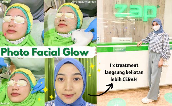 ZAP, ZAP clinic, ngezap hari ini, ngezap yuk, ngezap aman, happy zap life, photo facial glow, review photo facial glow zap, review zap photo facial glow, treatment photo facial glow