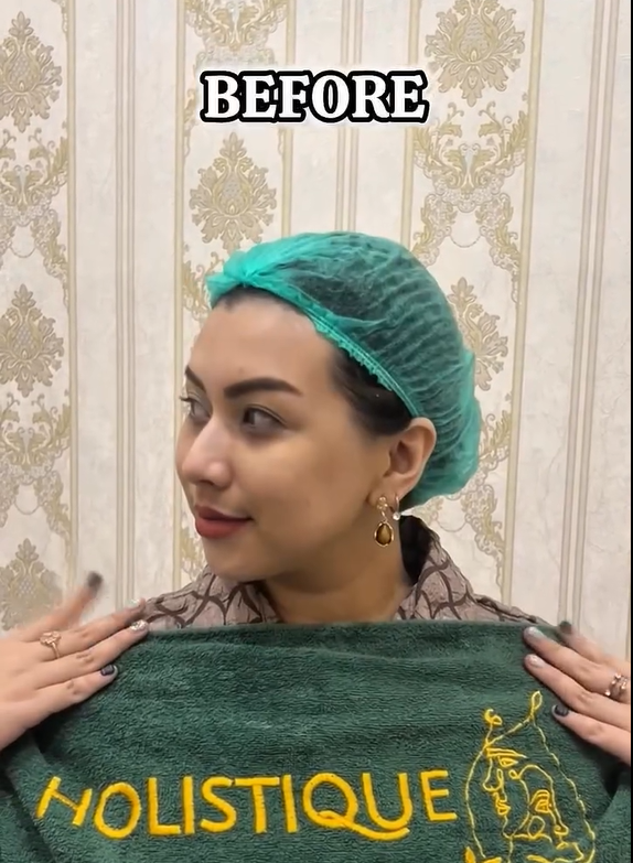 First Time Treatment Wajah di Holistique Clinic Jakarta Selatan – Worth It 2