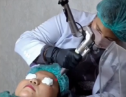 Hasil Treatment Wajah di Holistique Clinic Jakarta Selatan Honest Review