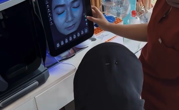 Treatment Wajah di Holistique Clinic Jakarta Selatan, Worth It Nggak