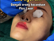 Nyobain Treatment di Klinik Holistique, Begini Rasanya
